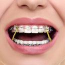 JMU Orthodontic Elastics 3/16 Medium 4.5oz 500 pack Orthodontic Rubber Bands Latex Dental Rubber Bands Made in USA JMU