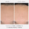 First Aid Beauty - 0.3% Retinol Complex Serum with Peptides, Designed for Sensitive Skin, Helps Visibly Improve Lines and Wrinkles with Less Irritation than Traditional Retinol, Non-Comedogenic, 1 oz Infinity Warehouse