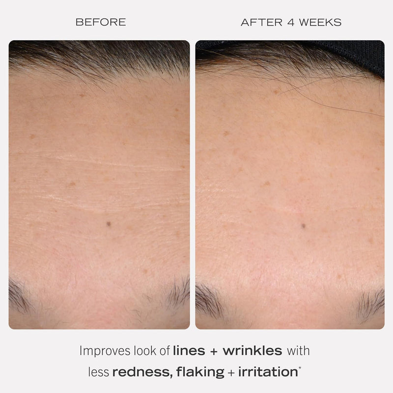 First Aid Beauty - 0.3% Retinol Complex Serum with Peptides, Designed for Sensitive Skin, Helps Visibly Improve Lines and Wrinkles with Less Irritation than Traditional Retinol, Non-Comedogenic, 1 oz Infinity Warehouse