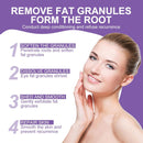 Milia Remover Cream for Eyes and Face,Milia Spot Remover with Salicylic Acid ,Milia Acne Cream (1 Fl Oz (Pack of 1)) Infinity Warehouse