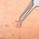 Beaute Galleria Premium Stainless Steel Bend Curved Blemish Extractor Tool for Remove Comedones Whitehead Blackhead Acne Pimple BEAUTÉ GALLERIA