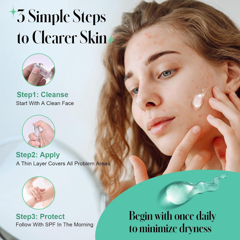 Salicylic Acid Spot Treatment Gel – 2% BHA Acne Treatment for Face, Helps Clear Breakouts & Blackheads, Oil-Free & Non-Irritating Formula, 0.35 Fl Oz Infinity Warehouse