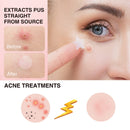OMINT Acne Patches- Hydrocolloid Acne Spot Skin Treatment, Blemish Spot, Facial Stickers, Invisible Pimple Patches Blends in with skin,Three Sizes (108 Count) OMINT