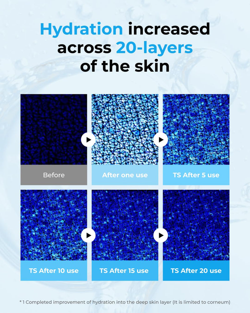 BOM Hyaluronic Acid Moisturizing Serum 1.69 fl oz, Lightweight Vegan Facial Serum with Moisture Capsules and Vitamins, Deep 20 Layer Hydration, Face Plumping, Hypoallergenic, Dry Skin Korean Skincare Infinity Warehouse