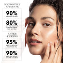 ZealSea Hyaluronic Acid Serum for Face, Hydrating Microneedling Serum, EWG Certified for Sensitive Skin, Vegan Fragrance Free Non-Comedogenic Absorb Quickly, Pure Hyaluronic Acid Anti-Aging 1 Oz*2 Infinity Warehouse