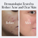 Geologie Daily Face Wash for Sensitive Skin | Fragrance-Free Facial Cleanser for Men & Women | Acne & Oil Control | Non-irritating, Gentle Cleansing & Soothing Face Wash | 2-Pack Infinity Warehouse