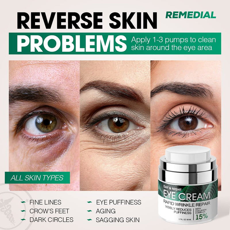 Eye Cream for Dark Circles Wrinkles Puffiness and Bags Under Eyes – Anti-Aging Collagen Eye Cream – Day and Night Formula with Caffeine, Dimethicone and Vitamin B – 1.7 Oz REMEDIAL