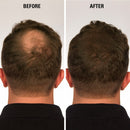 Eclipse Hair Fibers for Thinning Hair (BLACK) For Women & Men - 100% Undetectable Fibers - 15g Bottle - Completely Conceals Hair Loss in 15 Seconds Eclipse Instant Hair Filler