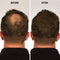 Infinity Hair Fiber - Hair Loss Concealer - Hair Thickening Fiber for Men & Women - Black, 15g Infinity