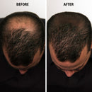 Eclipse Hair Fibers for Thinning Hair (LIGHT BLONDE) For Women & Men - 100% Undetectable Fibers - 15g Bottle - Completely Conceals Hair Loss in 15 Seconds Eclipse Instant Hair Filler Store