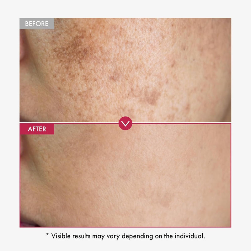 Niacinamide 10% + Tranexamic Acid 4% Serum, Arbutin 2%, Hyaluronic Acid, TXA Facial Serum, Glass Skin, Clarifying, Radiant Complexion with Natural Color, Korean Skin care, 33ml, 1.11 fl.oz. Infinity Warehouse