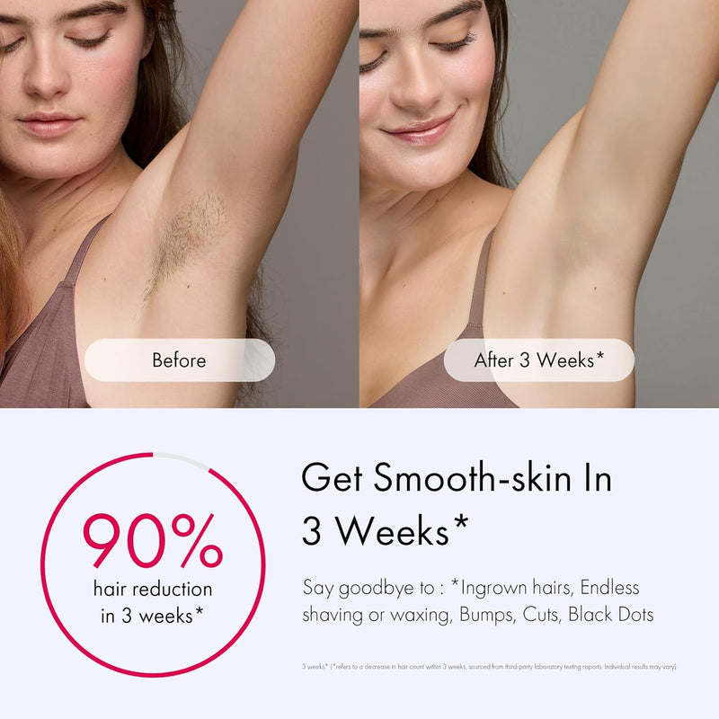 Ulike Laser Hair Removal for Women and Men, Air 3 Ice-Cooling IPL Device Hair Removal for Nearly Painless & Long-Lasting Results, 3 Modes & Auto Flashing for Fast Full Body Hair Removal from Home Infinity Warehouse