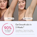 Ulike Laser Hair Removal for Women and Men, Air 3 Ice-Cooling IPL Device Hair Removal for Nearly Painless & Long-Lasting Results, 3 Modes & Auto Flashing for Fast Full Body Hair Removal from Home - Infinity Warehouse