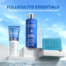 Hermon Folliculitis Shampoo for Itchy Scalp: Psoriasis, Dandruff & Seborrheic Dermatitis & Biotin – Soothes | Exfoliates | Reactivates Follicles Infinity Warehouse