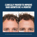 Nutrafol Men's Hair Growth Supplements, Clinically Tested for Visibly Thicker Hair and Scalp Coverage, Dermatologist Recommended - 3 Month Supply, Pack of 3 Infinity Warehouse