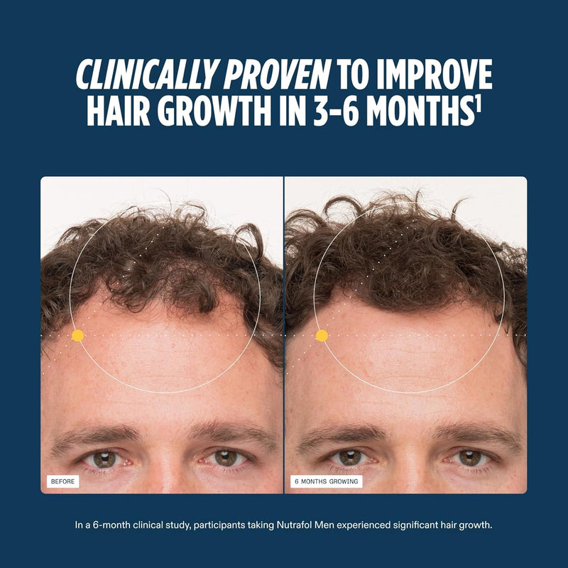 Nutrafol Men's Hair Growth Supplements, Clinically Tested for Visibly Thicker Hair and Scalp Coverage, Dermatologist Recommended - 3 Month Supply, Pack of 3 Infinity Warehouse