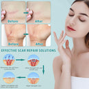 Advanced Scar Cream, Silicone Gel for Scars, Professional Scar Removal Cream for Surgical Scars, Stretch Marks, Old and New Scars 1.7 oz(50ml) Infinity Warehouse