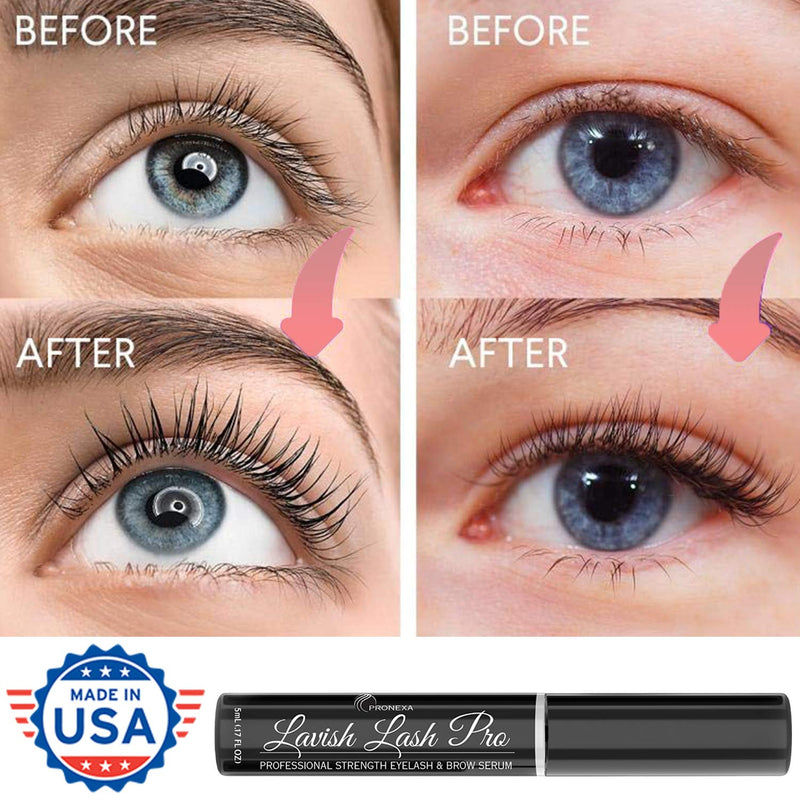 Lavish Lash Pro by Pronexa Hairgenics. Professional Strength Eyelash & Eyebrow Growth Serum. Over 20 Active Growth Promoting Ingredients for the Longest, Fullest Lashes & Brows. 5mL, 6 Month Supply. Pronexa