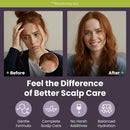 Marie Originals Eczema & Psoriasis Nourishing Shampoo and Conditioner Bundle – Itchy Scalp Relief, Dry Scalp Shampoo & Hydrating Conditioner with Tea Tree, Lavender & Peppermint – 8 oz Each Infinity Warehouse