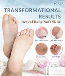 Foot Peel Exfoliating Mask (2 pack) - Deep Skin Exfoliation for Dry Cracked Feet, Calluses, and Rough Heels for Men & Women. Get Baby-Soft and Smooth Feet with Scala Foot Peel Mask Scala