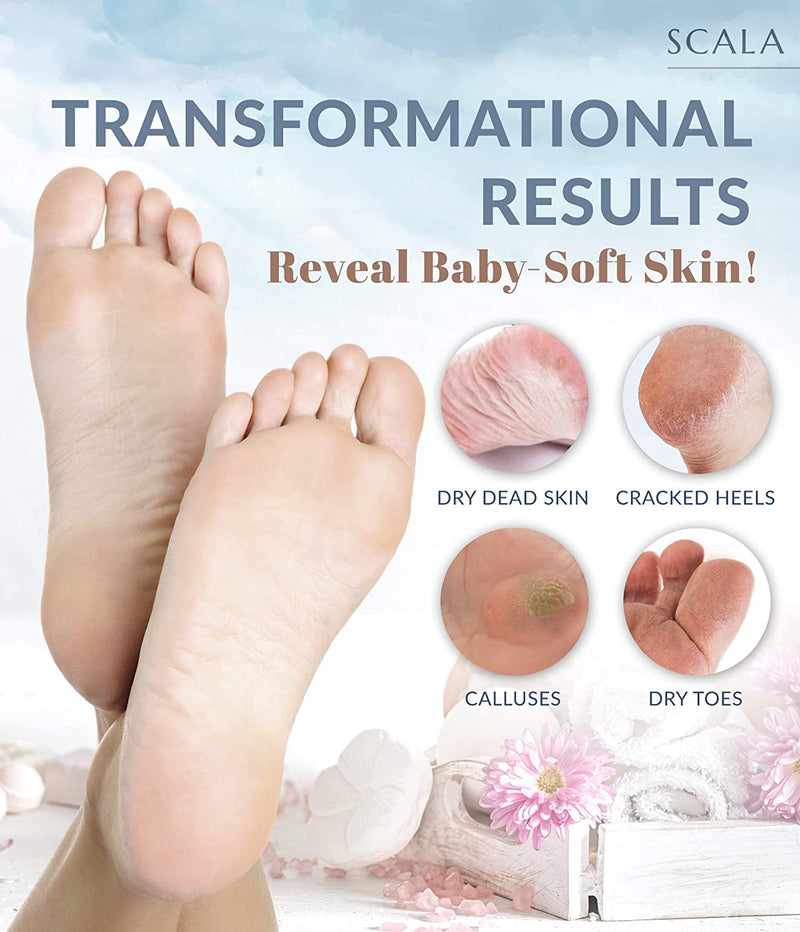 Foot Peel Exfoliating Mask (2 pack) - Deep Skin Exfoliation for Dry Cracked Feet, Calluses, and Rough Heels for Men & Women. Get Baby-Soft and Smooth Feet with Scala Foot Peel Mask Scala