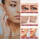 MZONG Non - Wireless RF Skin Rejuvenator - LED Light Combo for Face & Body Wrinkle Reduction Infinity Warehouse