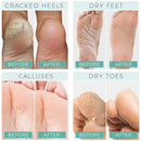 Foot Peel Mask - Aloe Vera - For Cracked Heels, Dead Skin and Calluses - Make Your Feet Baby Soft Smooth Silky Skin - Removes Rough Heels, Dry Toe Skin Exfoliating Treatment. (Men's 2 Pack) DERMORA