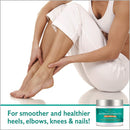 Urea Cream 40 Percent For Feet Maximum Strength Gel Softens Cracked Heel Calluses & Thick Toenails GILDEN TREE