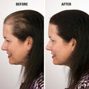 Eclipse Hair Fibers for Thinning Hair (BLACK) For Women & Men - 100% Undetectable Fibers - 15g Bottle - Completely Conceals Hair Loss in 15 Seconds Eclipse Instant Hair Filler