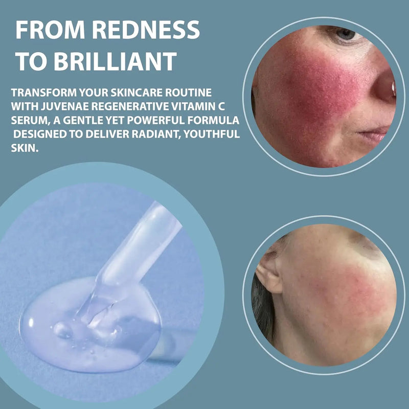 Regenerative Serum for Skin Tightening, Skin Care Serum, Facial Serum for Wrinkle Reduction, and Rejuvenation with Stem Cell Growth Factors and Advanced Peptides – 1 fl oz Infinity Warehouse