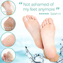 Foot Peel Mask - Aloe Vera - For Cracked Heels, Dead Skin and Calluses - Make Your Feet Baby Soft Smooth Silky Skin - Removes Rough Heels, Dry Toe Skin Exfoliating Treatment. (Men's 2 Pack) DERMORA