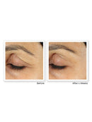 RoC Retinol Correxion Under Eye Cream for Dark Circles & Puffiness, Daily Wrinkle Cream, Anti Aging Line Smoothing Skin Care Treatment, 0.5 oz (Packaging May Vary) RoC