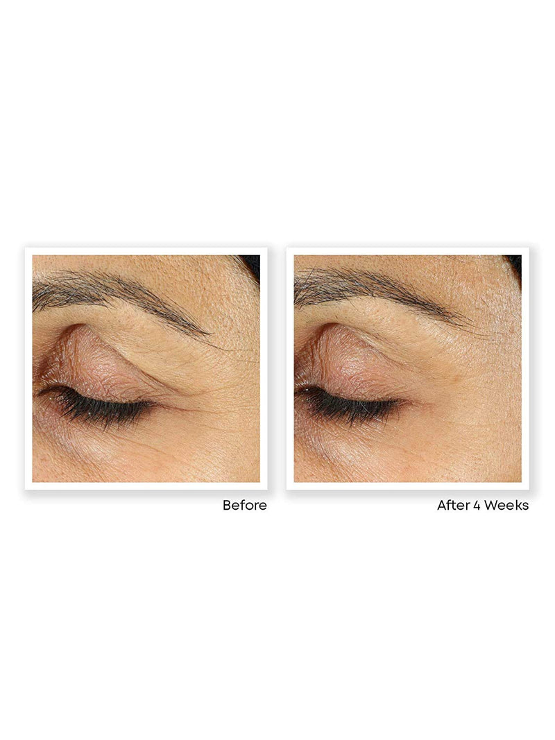 RoC Retinol Correxion Under Eye Cream for Dark Circles & Puffiness, Daily Wrinkle Cream, Anti Aging Line Smoothing Skin Care Treatment, 0.5 oz (Packaging May Vary) RoC