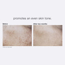 PCA SKIN Hydroquinone-Free Pigment Gel Face Serum - Spot Treatment Facial Corrector with Kojic & Lactic Acid for Brightening Dark Spots & Hyperpigmentation (1 fl oz) PCA SKIN