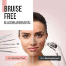 The Good Stuff Black Head Removal Tools with Mirrored Travel Case, 5 pcs Kit, Black The Good Stuff