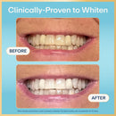 Lumineux 2-in-1 Whitening Pen Enamel Safe and Clinically Proven to Whiten Without The Sensitivity - Removes Coffee, Tea, and Smoking Stains Infinity Warehouse