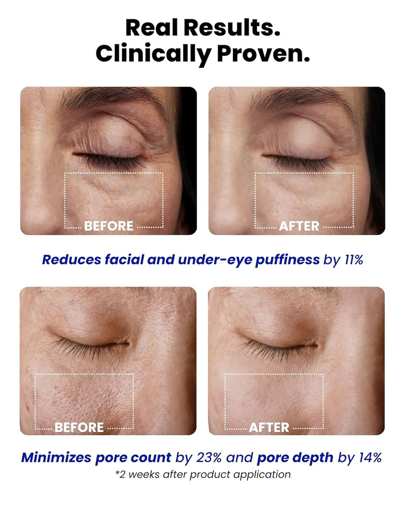 Ice Roll Serum | Cooling & Hydrating Roll-On Serum for Face, Puffy Eyes, Tannin & Panthenol for Pore Minimizing, Soothing, Facial Roller for Depuffing, Under Eye Bag Treatment | Korean Skin Care Infinity Warehouse