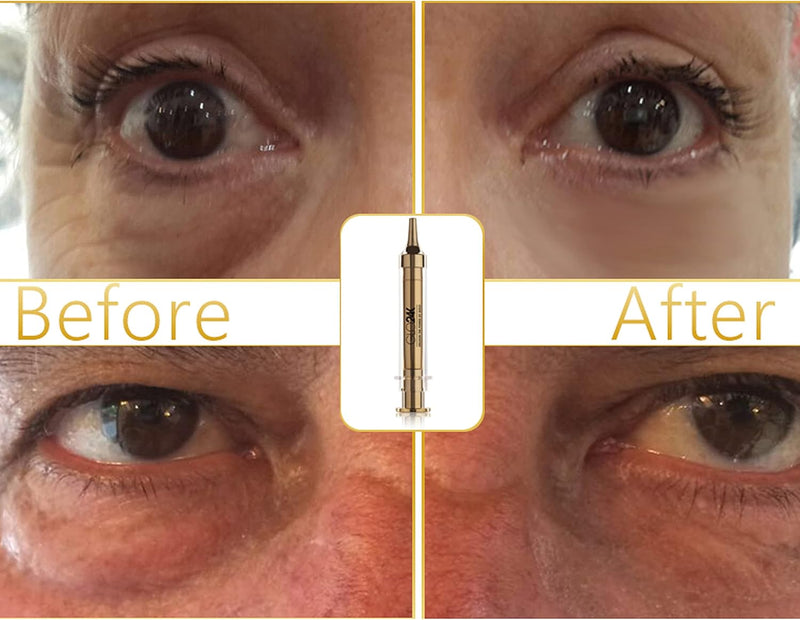 GLO24K Instant Facelift Cream with 24k Gold, Hyaluronic Acid, Peptides, and Vitamins. Value Pack of 3. A powerful non-invasive alternative to injections.