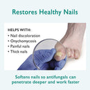 Urea Cream 40 Percent For Feet Maximum Strength Gel Softens Cracked Heel Calluses & Thick Toenails GILDEN TREE
