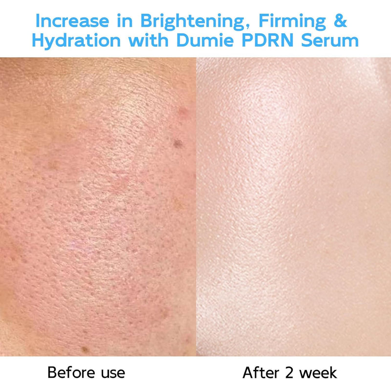 Salmon DNA PDRN Anti-Aging Serum, 5000ppm Salmon Egg DNA Ampoule, 2000ppm Collagen, Glutathione, Niacinamide & 6 Hyaluronic Acids, Korean Skincare for Wrinkles & Radiance,0.05 fl.oz x 30e Infinity Warehouse