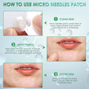 AUSLKA Micro-needle Acne Pimple Patch (9 Patches), Acne Dots for Face, Zit Patches, Pimple Stickers AUSLKA Store
