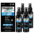 5% Minoxidil for Men Hair Loss Treatment, Minoxidil for Women Hair Growth Spray, For Men & Women, Supports Thinning Hair, With Biotin, Easy Daily Application (240ml) Infinity Warehouse