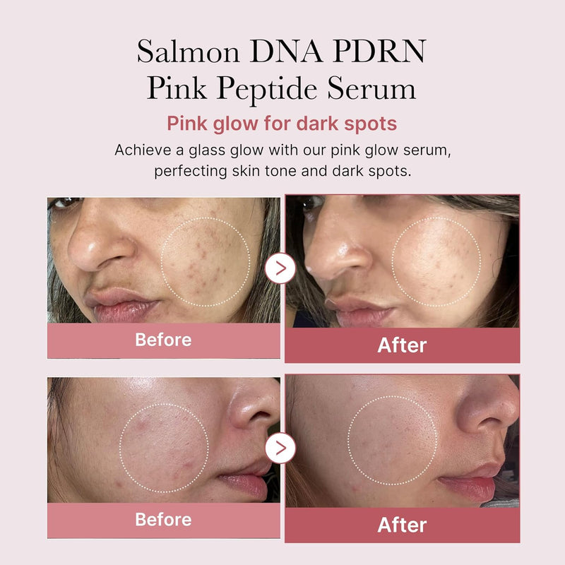medicube Salmon DNA PDRN Pink Peptide Serum, Pink glow serum, Peptide, Niacinamide, Hydrating & Moisturizing & Firming, Uneven Skin Tone, Korean Skincare | 1.01 fl.oz. (1.01 fl.oz., Salmon DNA PDRN) Infinity Warehouse