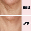 SiO Beauty FaceLift | Neck, Forehead, Eye & Smile Anti-Wrinkle Patches | Overnight Smoothing Silicone Patches For Face, Neck, Forehead, Eye & Smile Fine Lines And Signs Of Aging SiO Store