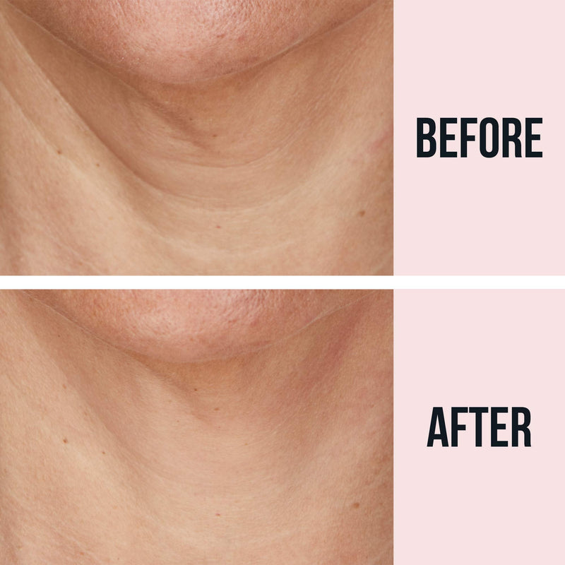 SiO Beauty FaceLift | Neck, Forehead, Eye & Smile Anti-Wrinkle Patches | Overnight Smoothing Silicone Patches For Face, Neck, Forehead, Eye & Smile Fine Lines And Signs Of Aging SiO