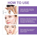 Milia Remover Cream for Eyes and Face,Milia Spot Remover with Salicylic Acid ,Milia Acne Cream (1 Fl Oz (Pack of 1)) Infinity Warehouse