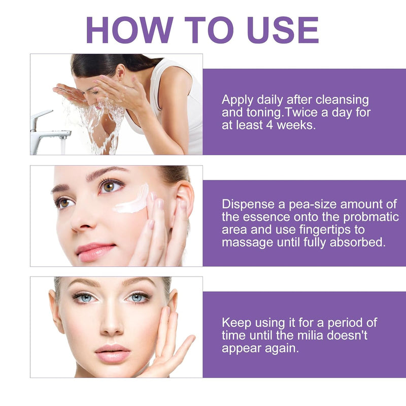 Milia Remover Cream for Eyes and Face,Milia Spot Remover with Salicylic Acid ,Milia Acne Cream (1 Fl Oz (Pack of 1)) Infinity Warehouse