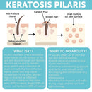 KP Bump Eraser Body Set with 10% AHA | Keratosis Pilaris Treatment | Keratosis Pilaris Lotion | Exfoliating Body Scrub | Ingrown Hair Treatment | Bundle Set for Bump, Strawberry Legs, Redness, Dryness Infinity Warehouse