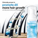 5% Minoxidil Foam for Men, Minoxidil for Women Hair Growth, Infused with Biotin, Hair Growth Treatment, Foam Hair Regrowth Treatment for Hair Thinning Receding Hairline,(2 oz Bottle), 3-Pack Infinity Warehouse