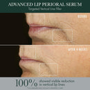 RéVive Advanced Perioral Lip Serum - Anti Aging Perioral Lip Treatment to Reduce Lip Area Lines & Wrinkles -Helps Restore Lip Contour & Visible Fullness(0.5 fl oz) Infinity Warehouse